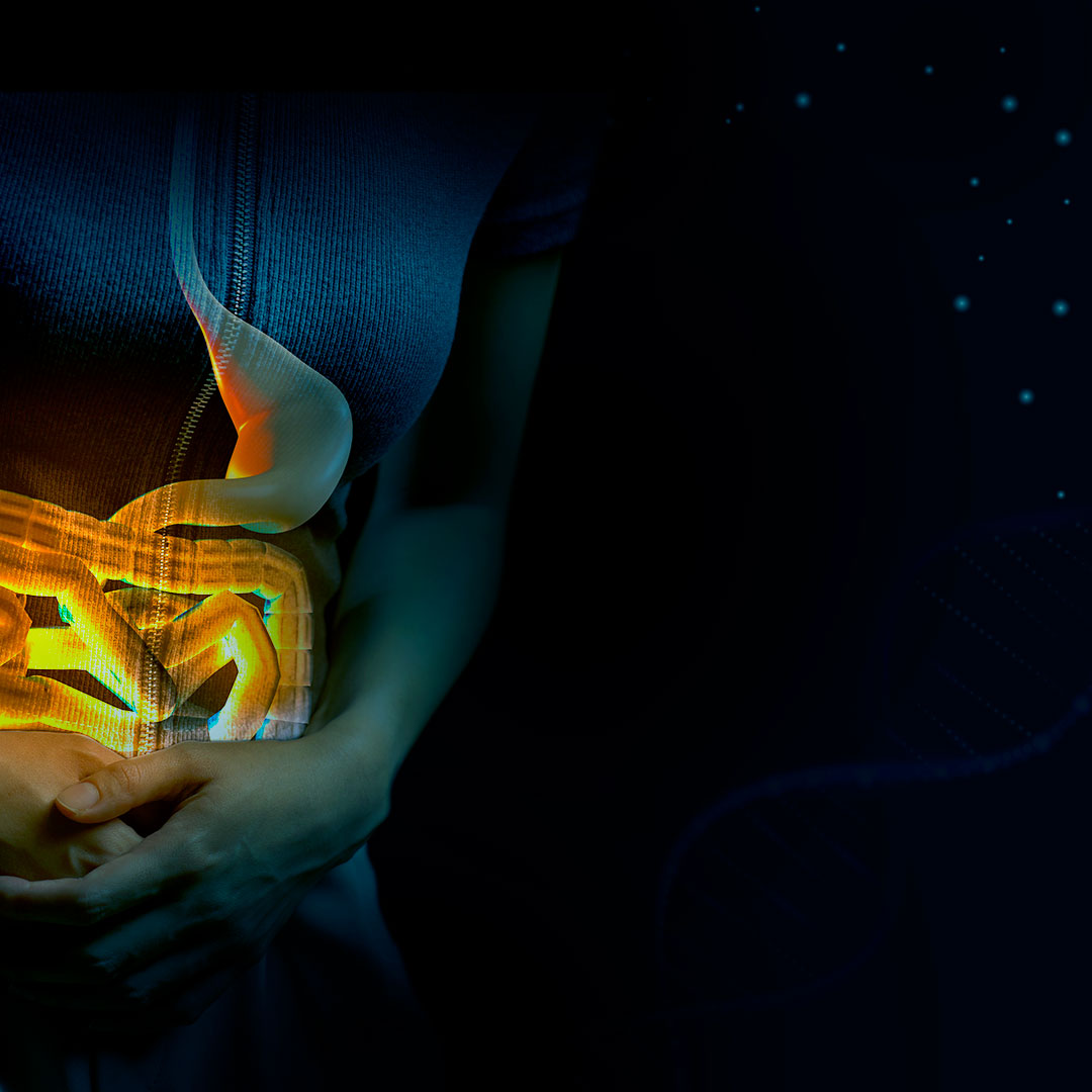 Modulação da Microbiota Intestinal – Upsell